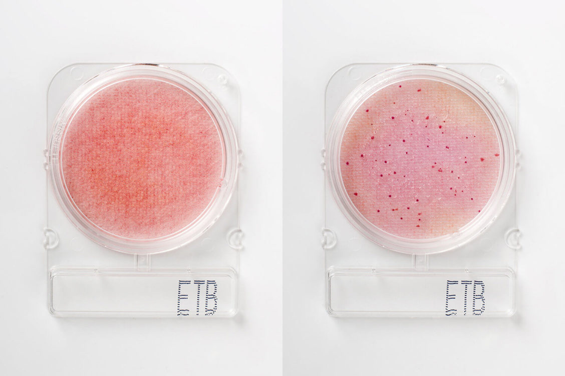 Compact Dry ETB bakterietester for måling av Enterobacteriaceae