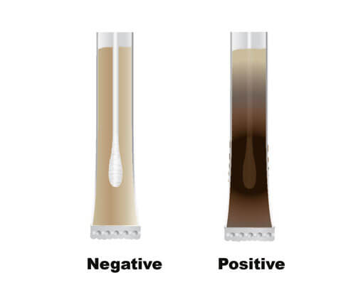 Listeria spp.